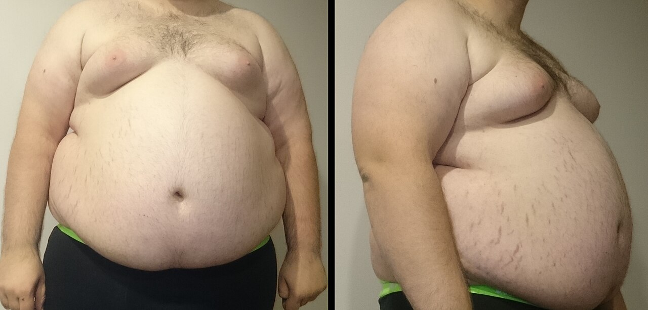 Mastering Insulin Administration