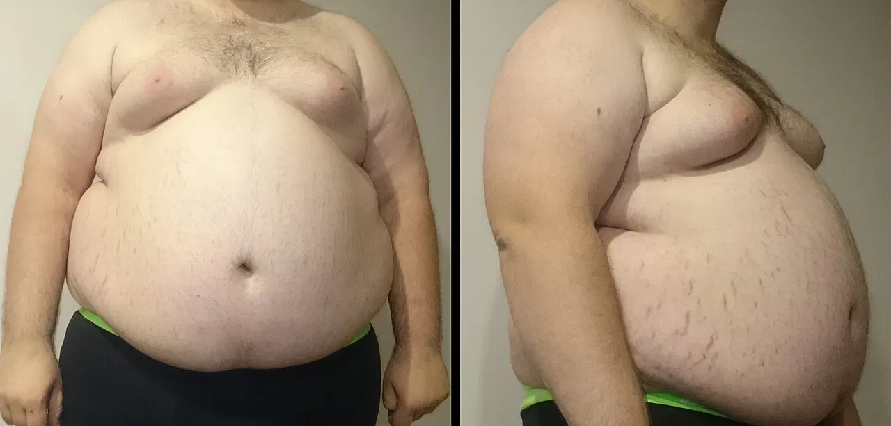Mastering Insulin Administration